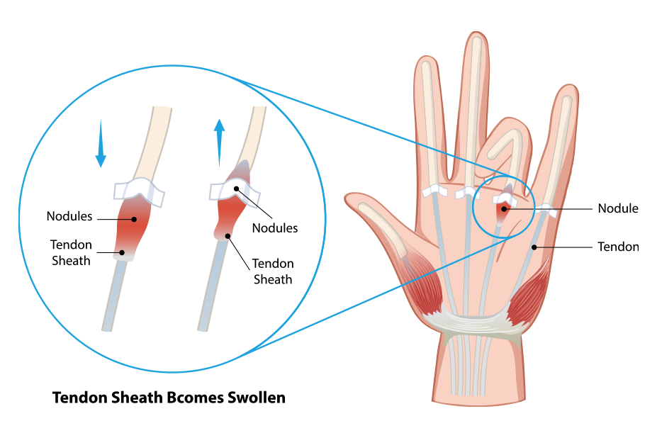 Hand – FLEX Institute